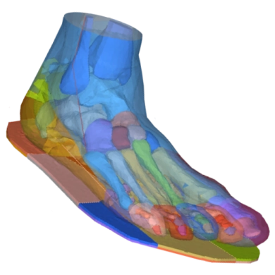 Modèle biomécanique par éléments finis transparent et coloré d'un pied humain et de la cheville, posé sur une semelle orthopédique segmentée, simulé avec Siemens Radioss.