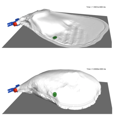 Simulation numérique en deux étapes (1.5 ms et 5.0 ms) du déploiement d'un airbag automobile, montrant le gonflage et l'expansion de la structure du coussin, réalisée avec Siemens Radioss.